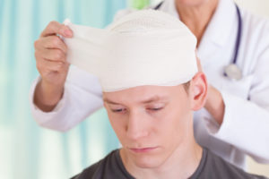 What Causes a Traumatic Brain Injury?